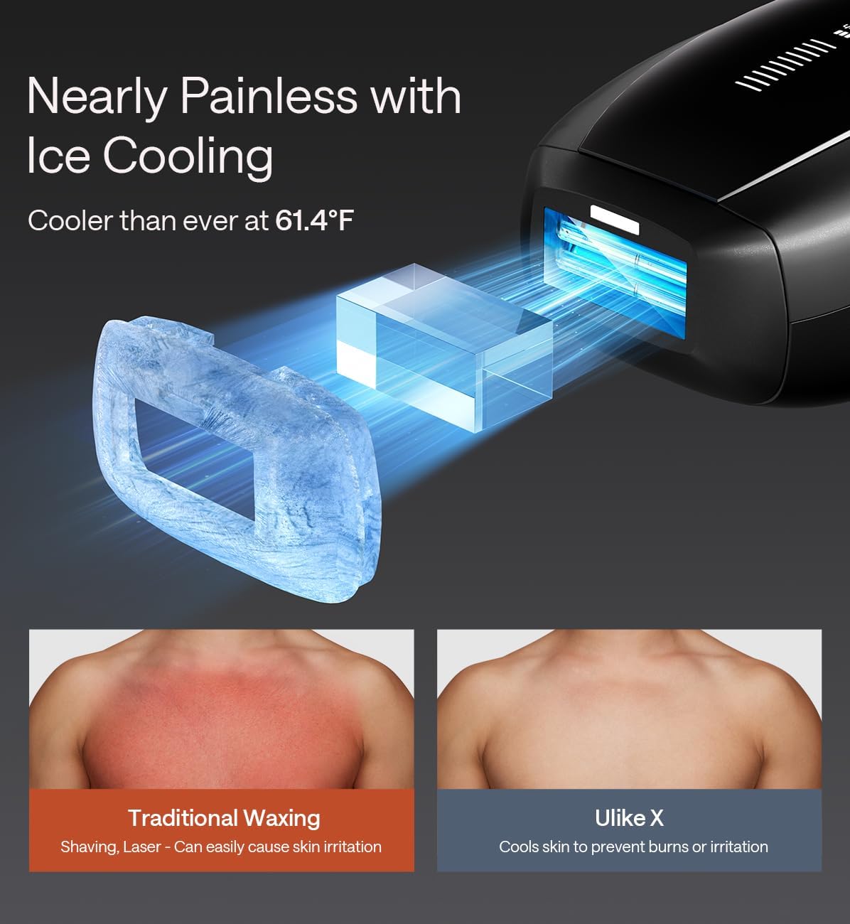 Ulike X Man IPL Hair Removal Device, Laser Hair Removal with Ice-Cooling, Dual Lights &amp; SkinSenor for Nearly Painless &amp; Long-Lasting Hair Removal, 3 Modes Tailored for Stubborn Hair, Gift Black