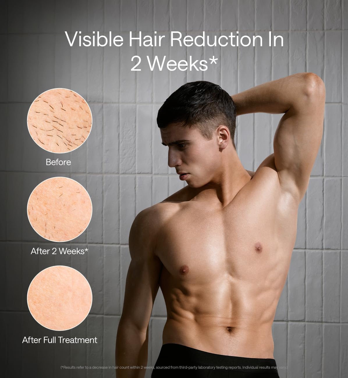 Ulike X Man IPL Hair Removal Device, Laser Hair Removal with Ice-Cooling, Dual Lights &amp; SkinSenor for Nearly Painless &amp; Long-Lasting Hair Removal, 3 Modes Tailored for Stubborn Hair, Gift Black